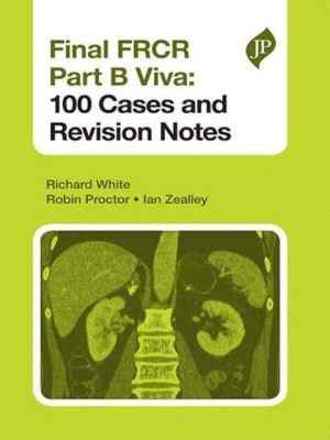 Final FRCR Part B Viva 100 Cases and Revision Notes Paperback – 1 January 2013 the booklance