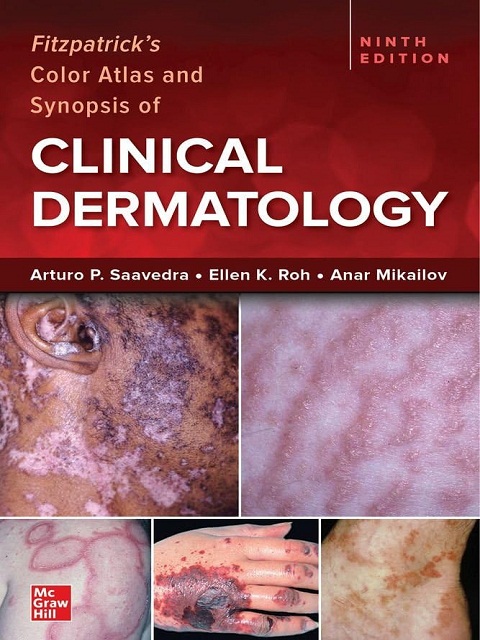 Fitzpatrick's Color Atlas and Synopsis of Clinical Dermatology, Ninth Edition 9th Edition Fitzpatrick's Color Atlas and Synopsis of Clinical Dermatology, Ninth Edition 9th Edition