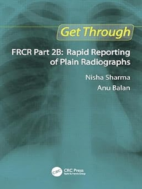 Get Through FRCR Part 2B: Rapid Reporting of Plain Radiogrpahs 1st Edition the booklance Get Through FRCR Part 2B: Rapid Reporting of Plain Radiogrpahs 1st Edition the booklance