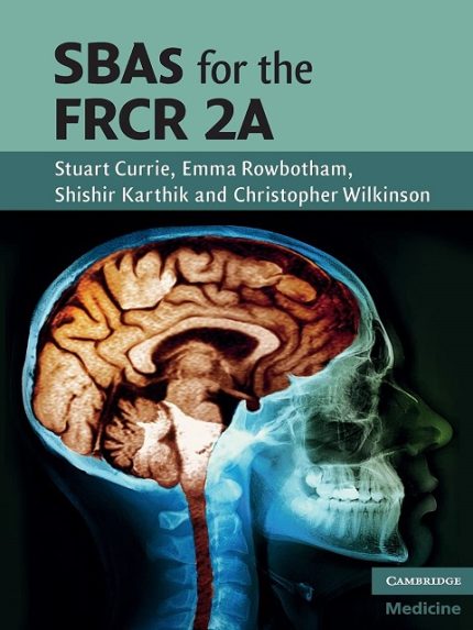 sbas for the frcr 2a (cambridge medicine (paperback)) 1st edition