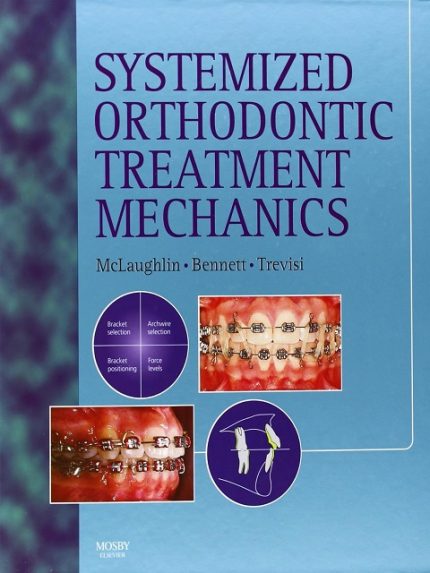systemized orthodontic treatment mechanics 1st edition