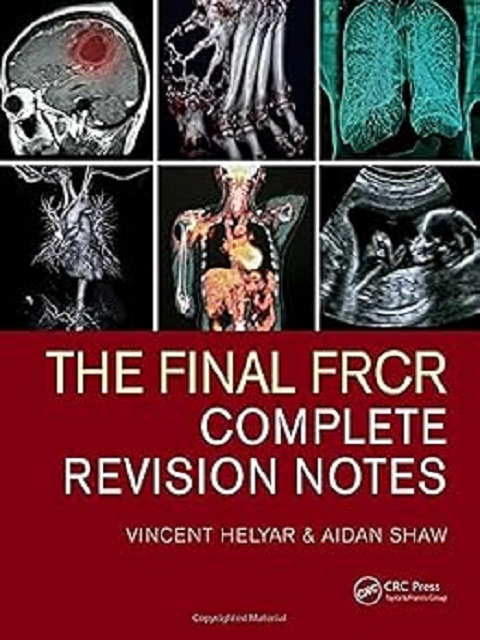 the final frcThe Final FRCR Complete Revision Notes 1st Edition the booklancer complete revision notes 1st edition The Final FRCR Complete Revision Notes 1st Edition the booklance