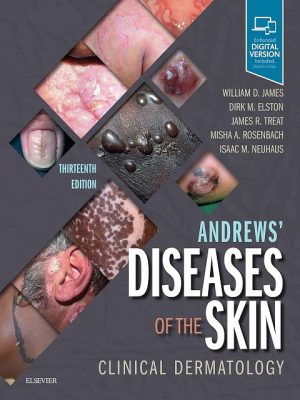 Andrews' Diseases of the Skin: Clinical Dermatology 13th Edition the booklance