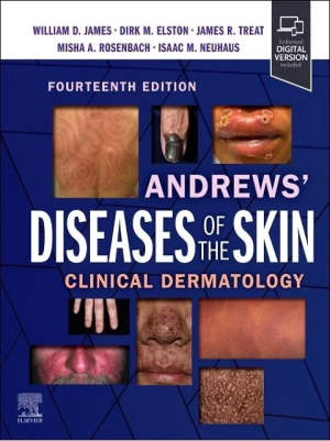 Andrews’ Diseases of the Skin: Clinical Dermatology 14th Edition the booklance