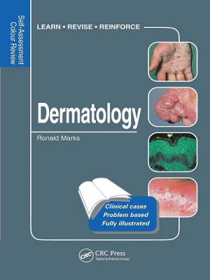 Dermatology Self-Assessment Colour Review 1st Edition