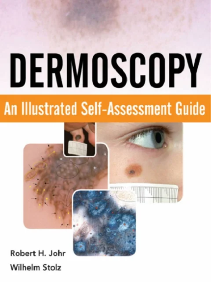 Dermoscopy: An Illustrated Self-Assessment Guide 1st Edition the booklance