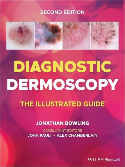 Diagnostic Dermoscopy: The Illustrated Guide 2nd Edition the booklance