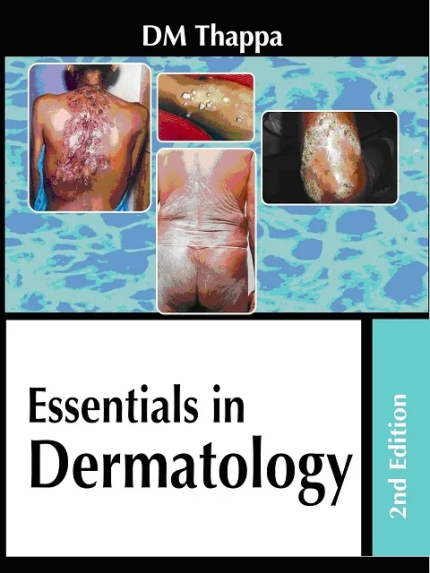Essentials in Dermatology 2nd Edition the booklance
