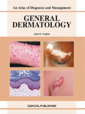 General Dermatology (Atlas of Investigation and Management) the booklance