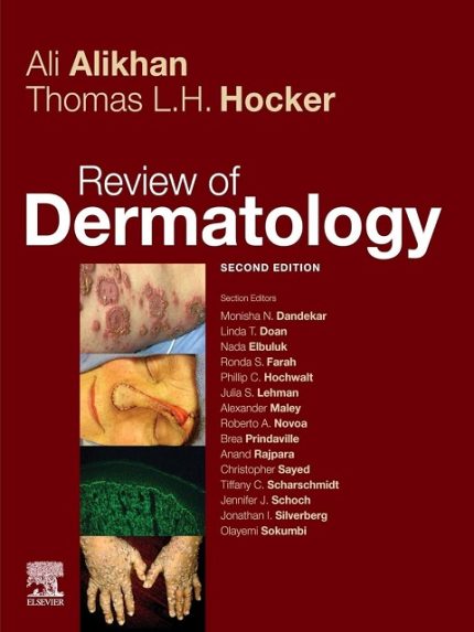 Review of Dermatology E-Book 2nd Edition the booklance