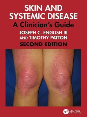 Skin and Systemic Disease: A Clinician’s Guide 2nd Edition the booklance