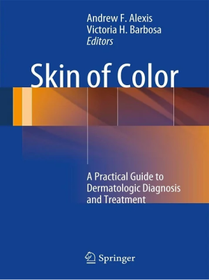 Skin of Color: A Practical Guide to Dermatologic Diagnosis and Treatment the booklance