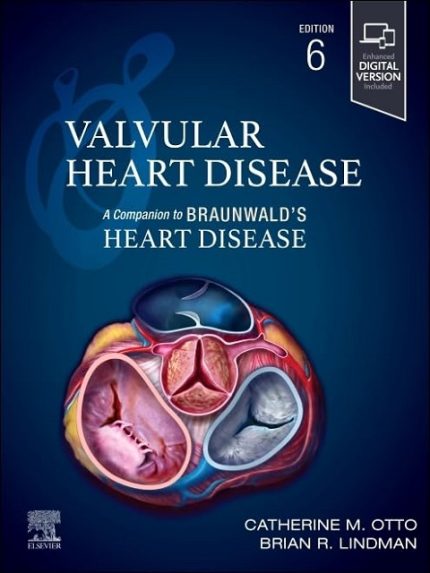 Valvular Heart Disease: A Companion to Braunwald's Heart Disease 6th Edition the booklance