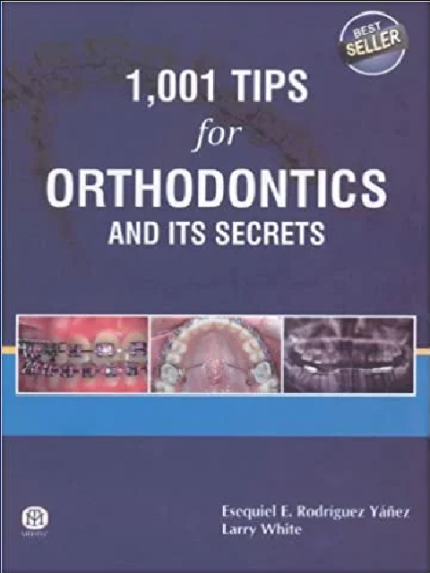 1001 Tips for Orthodontics and its Secrets