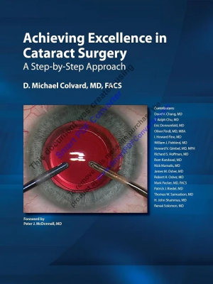 Achieving Excellence in Cataract Surgery A Step-by-Step Approach