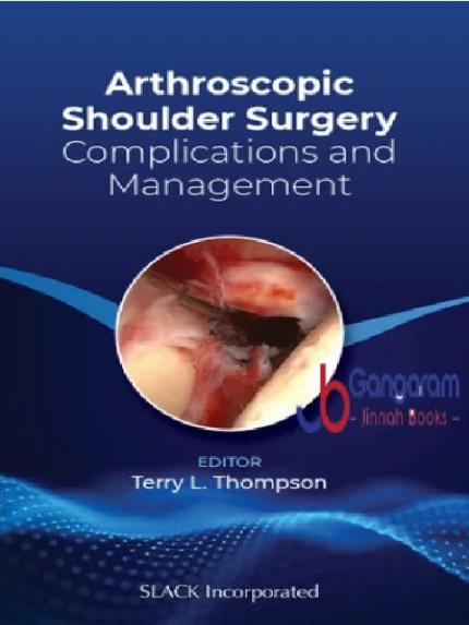 Arthroscopic Shoulder Surgery: Complications and Management