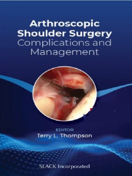 Arthroscopic Shoulder Surgery: Complications and Management