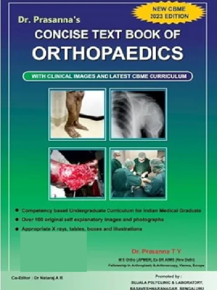Concise Textbook of Orthopaedics: CBME Curriculum-2023