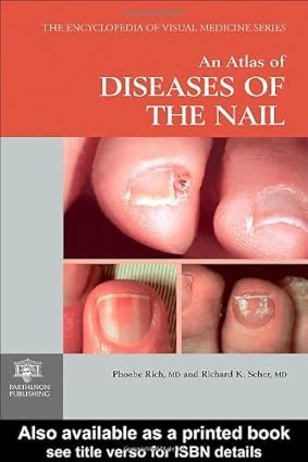 An Atlas of Diseases of the Nail