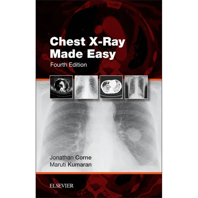 Chest X-Ray Made Easy – 4th Edition Practical Radiology Guide