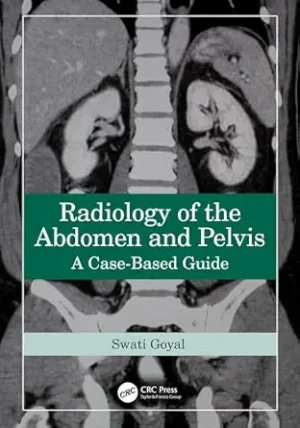 Radiology of the Abdomen and Pelvis: A Case-Based Guide 1st Edition