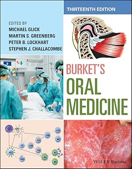 Burket's Oral Medicine 13th Edition