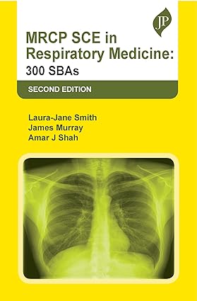 MRCP SCE in Respiratory Medicine: 300 SBAs 2nd Edition
