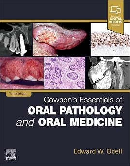 Cawson's Essentials of Oral Pathology and Oral Medicine 10th Edition