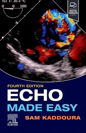 Echo Made Easy 4th Edition